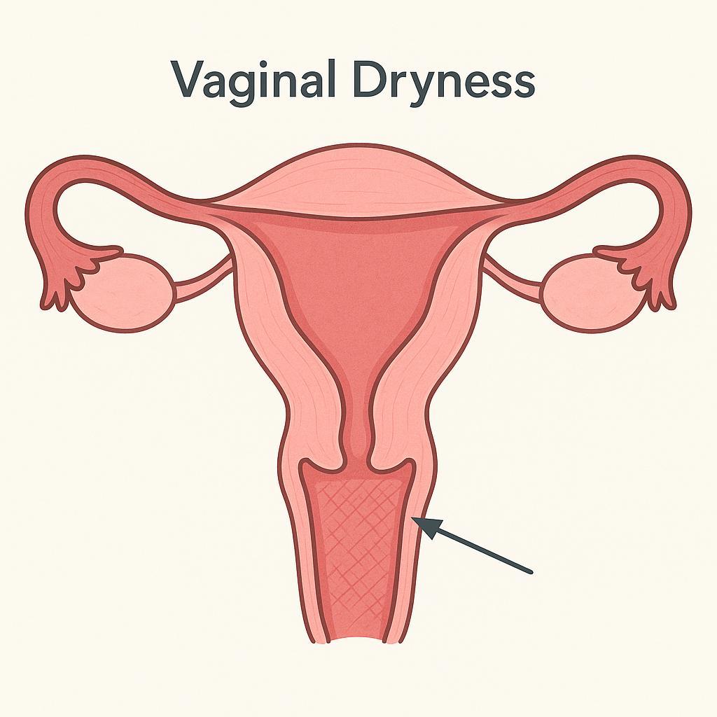 Homeopathy Medicines for Vaginal Dryness Treatment 