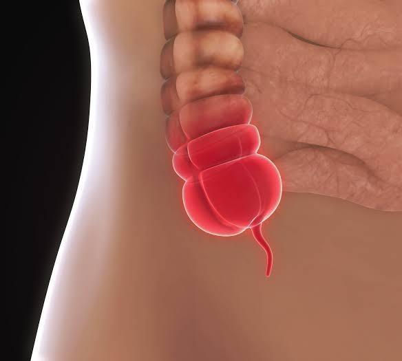 Homeopathy Medicines for Appendicitis Treatment