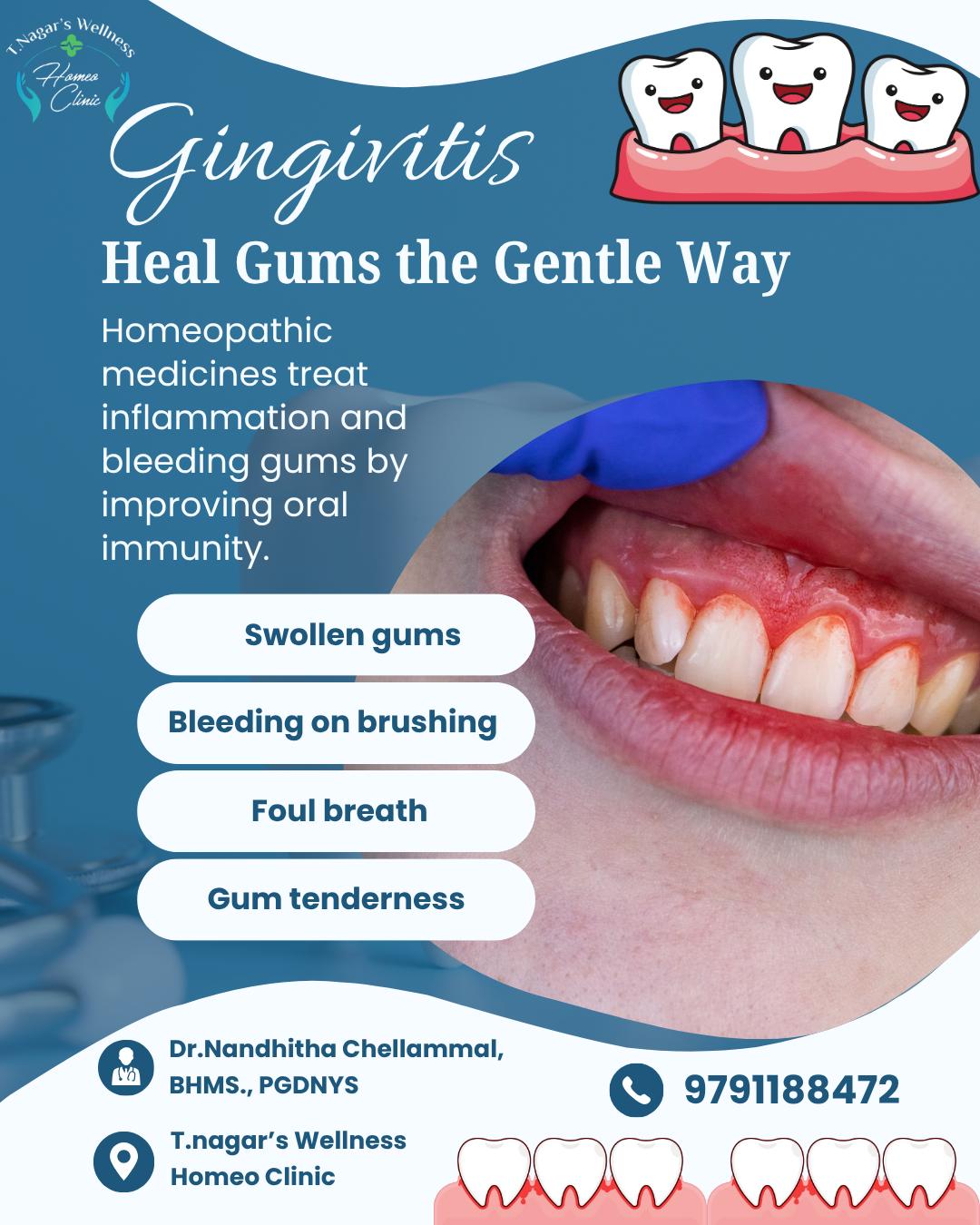 Homeopathy Medicines for Gingivitis Treatment 